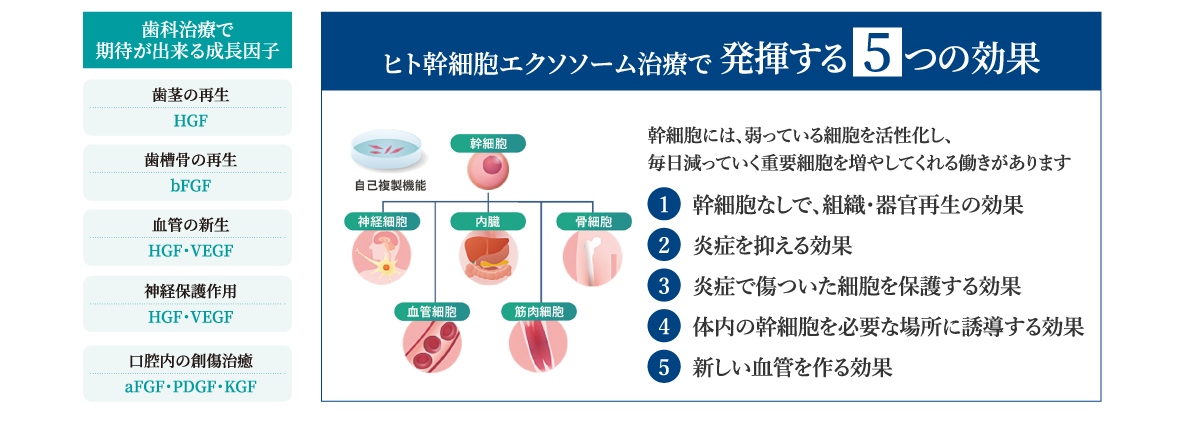 ヒト幹細胞エクソソーム治療で発揮する5つの効果。①幹細胞なしで、組織・器官再生の効果②炎症を抑える効果③炎症で傷ついた細胞を保護する効果④体内の幹細胞を必要な場所に誘導する効果⑤新しい血管を作る効果